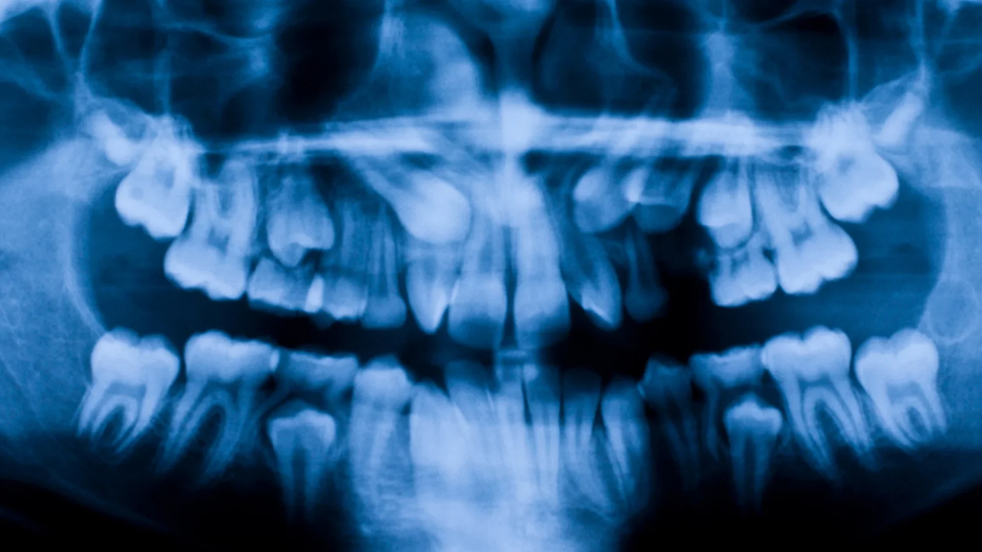 Dental X-Rays (2)