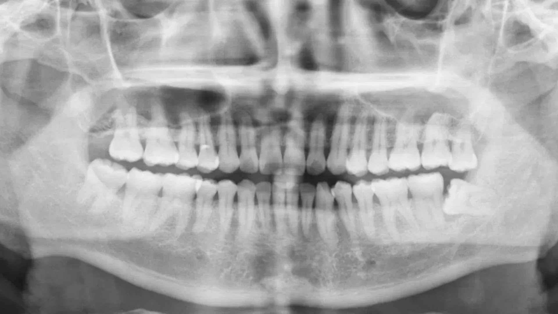 Dental X-Rays (4)
