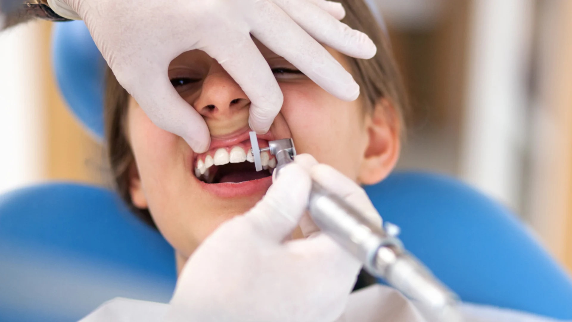 Scaling and Root Planing Clinic (4)